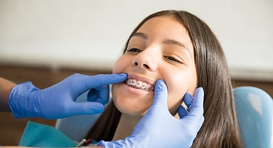 Ortodontik Tedaviler İçin ‘Ergenlik’ En İdeal Dönem